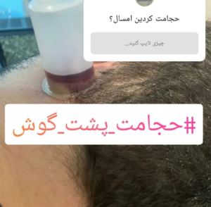 نمونه ماساژ مرکز حسین نادری