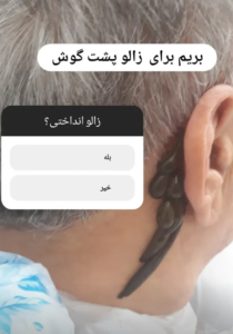 نمونه ماساژ مرکز حسین نادری