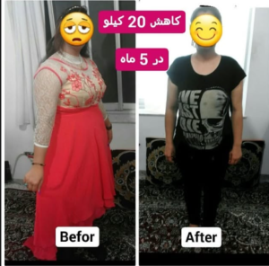 نمونه کاهش وزن با رژیم لاغری دکتر شیرین اباذری