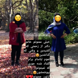 نمونه کاهش وزن با رژیم لاغری دکتر شیرین اباذری