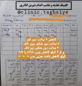 نمونه کاهش وزن با رژیم لاغری دکتر شیرین اباذری