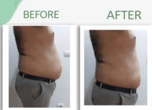 نمونه لاغری با رژیم و دستگاه دکتر سامره یعقوبیان