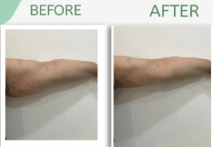 نمونه لاغری با رژیم و دستگاه دکتر سامره یعقوبیان