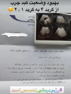 نمونه لاغری با رژیم دکتر سامره یعقوبیان