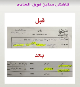 نمونه لاغری با رژیم دکتر سامره یعقوبیان