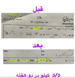 نمونه لاغری با رژیم دکتر سامره یعقوبیان