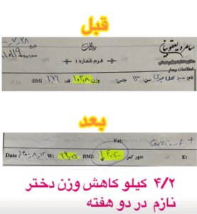 نمونه لاغری با رژیم دکتر سامره یعقوبیان
