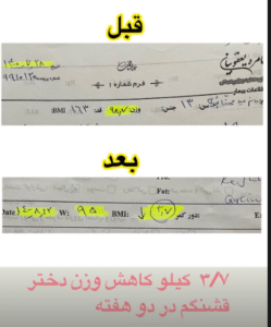 نمونه لاغری با رژیم دکتر سامره یعقوبیان