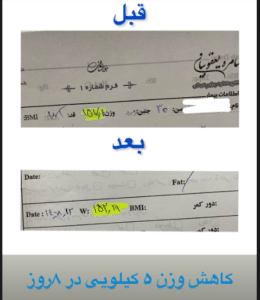 نمونه لاغری با رژیم دکتر سامره یعقوبیان