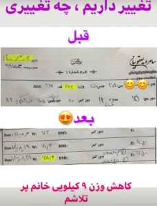 نمونه لاغری با رژیم دکتر سامره یعقوبیان