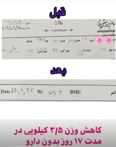 نمونه لاغری با رژیم دکتر سامره یعقوبیان