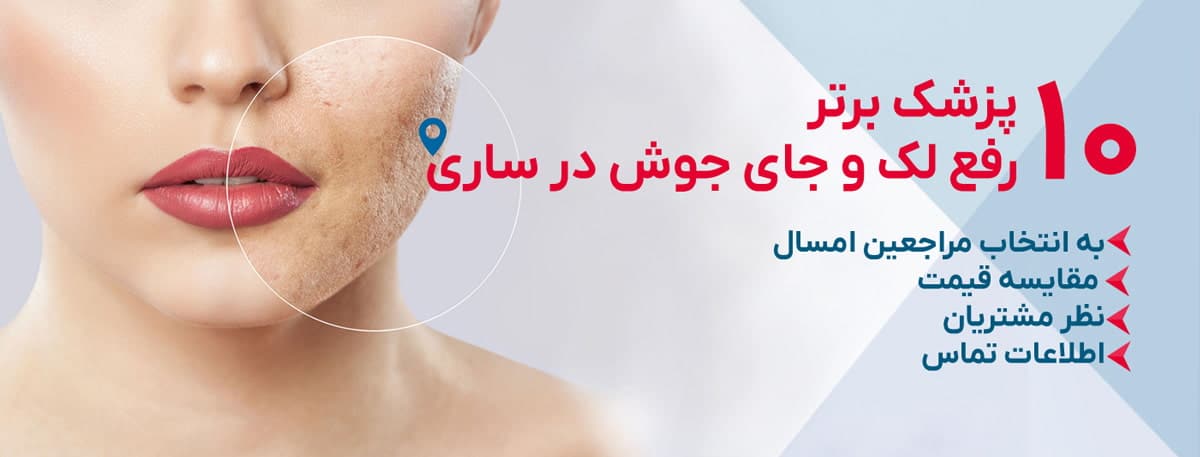 بهترین دکتر رفع لک و جای جوش در ساری
