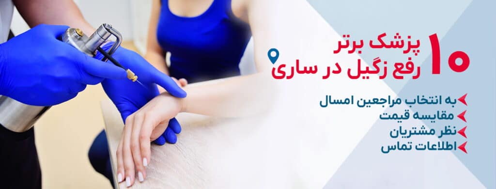 بهترین دکتر رفع زگیل در ساری