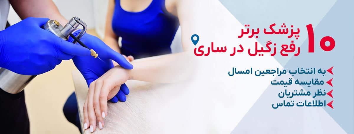 بهترین دکتر رفع زگیل در ساری