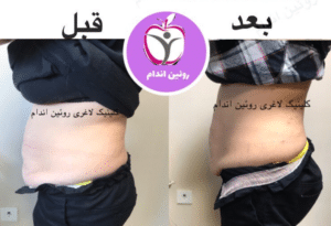 نمونه کاهش وزن با رژیم لاغری فاطمه روئین