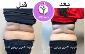 نمونه کاهش وزن با رژیم لاغری فاطمه روئین
