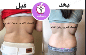 نمونه کاهش وزن با رژیم لاغری فاطمه روئین
