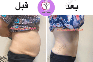 نمونه کاهش وزن با رژیم لاغری فاطمه روئین