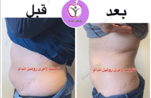نمونه کاهش وزن با رژیم لاغری فاطمه روئین
