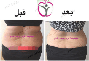 نمونه کاهش وزن با رژیم لاغری فاطمه روئین